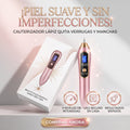 CAUTERIZADOR DE VERRUGAS